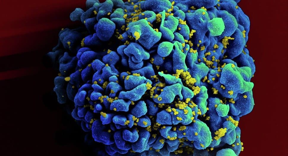 Las personas que padecen de VIH tienen un tratamiento que consiste en la combinación de varios fármacos