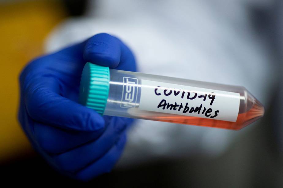 La ivermectina es aplicada in vitro para frenar el coronavirus COVID-19 / Foto  REUTERS/Thomas Peter