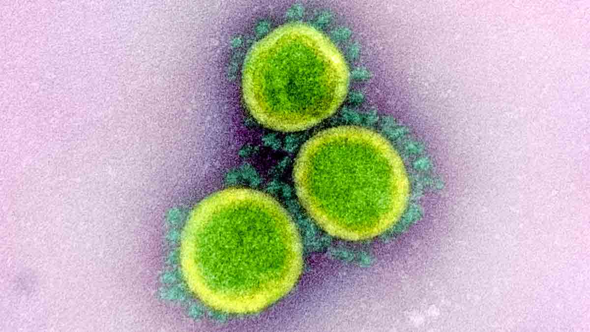 Cepa-del-virus-SARS-CoV-2_1
