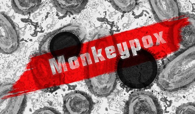 La viruela del mono sigue encendiendo las alarmas. Por ahora la enfermedad es "leve" y no afecta de forma importante a quienes la padecen. Foto Pixabay