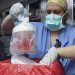 transplante de rinon a humano