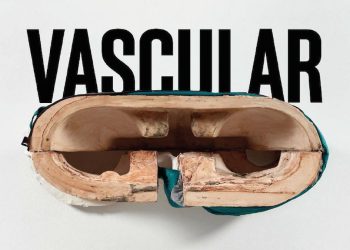 June vascular