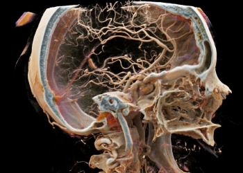 organo inmunitario cerebro